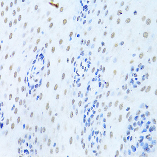 hnRNP K Antibody in Immunohistochemistry (Paraffin) (IHC (P))