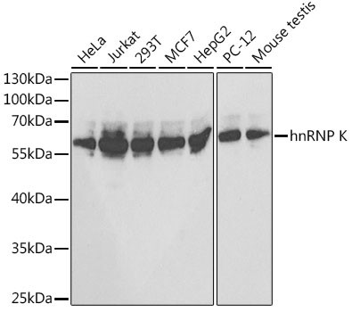 hnRNP K Antibody in Western Blot (WB)