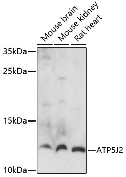 ATP5J2 Antibody in Western Blot (WB)