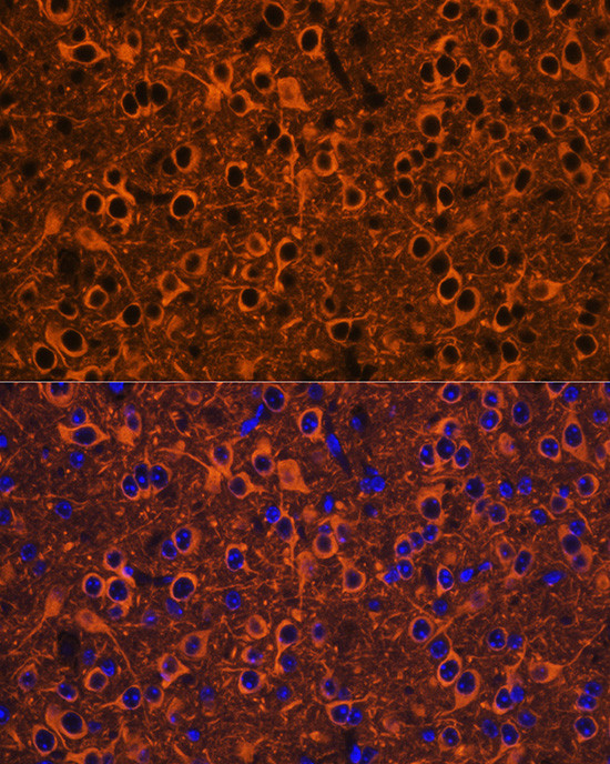 Beta III Tubulin Antibody in Immunohistochemistry (Paraffin) (IHC (P))