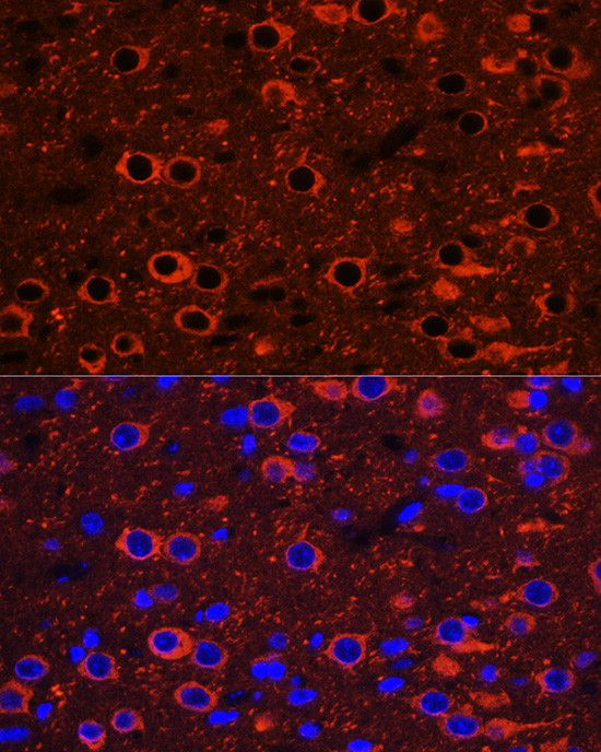 Beta III Tubulin Antibody in Immunohistochemistry (Paraffin) (IHC (P))