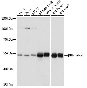 Beta III Tubulin Antibody in Western Blot (WB)