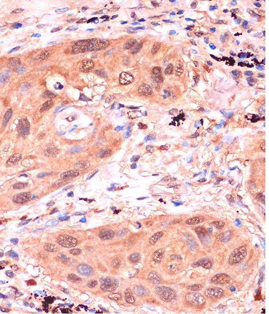 RPP38 Antibody in Immunohistochemistry (Paraffin) (IHC (P))