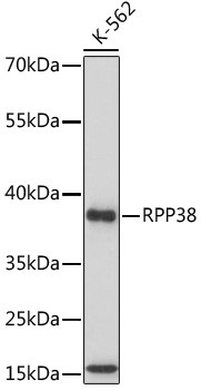 RPP38 Antibody in Western Blot (WB)