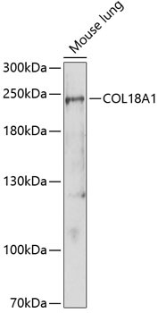 Endostatin Antibody in Western Blot (WB)