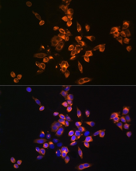 Annexin V Antibody in Immunocytochemistry (ICC/IF)