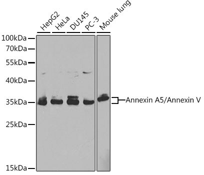 Annexin V Antibody in Western Blot (WB)