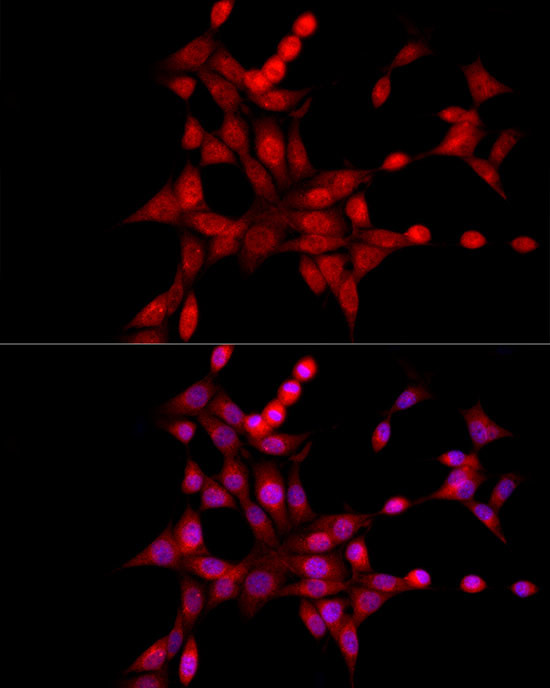 XBP1 Antibody in Immunocytochemistry (ICC/IF)