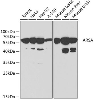 ARSA Antibody in Western Blot (WB)