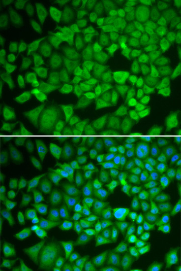 NR0B1 Antibody in Immunocytochemistry (ICC/IF)