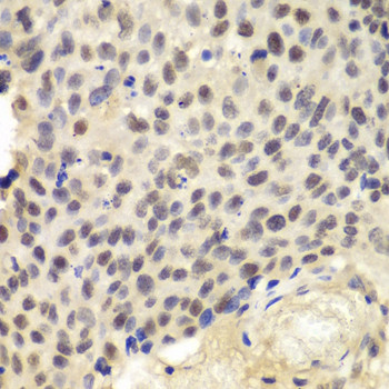 KPNA1 Antibody in Immunohistochemistry (Paraffin) (IHC (P))