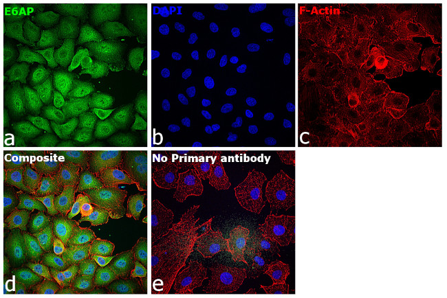 E6AP Antibody in Immunocytochemistry (ICC/IF)