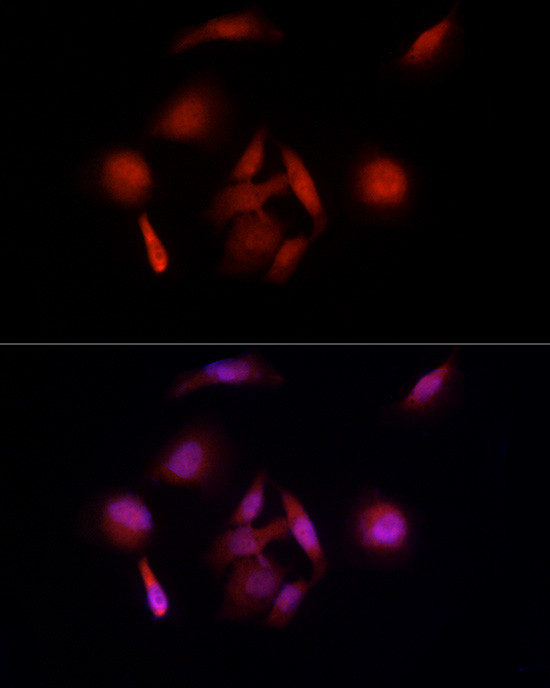 E6AP Antibody in Immunocytochemistry (ICC/IF)