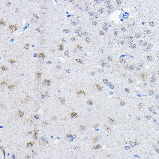 E6AP Antibody in Immunohistochemistry (Paraffin) (IHC (P))