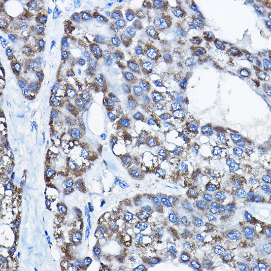 E6AP Antibody in Immunohistochemistry (Paraffin) (IHC (P))