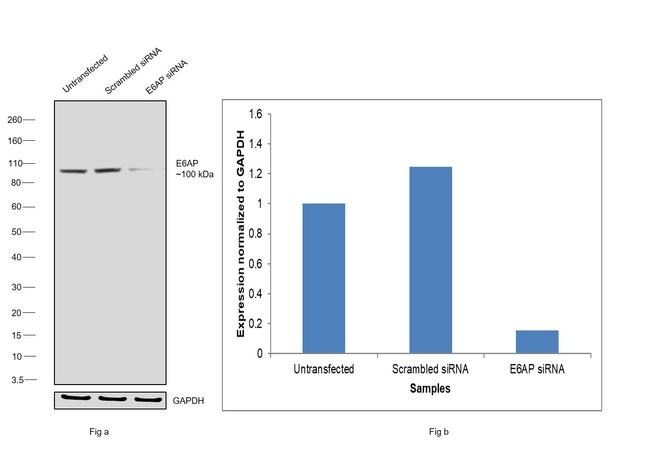 E6AP Antibody in Western Blot (WB)