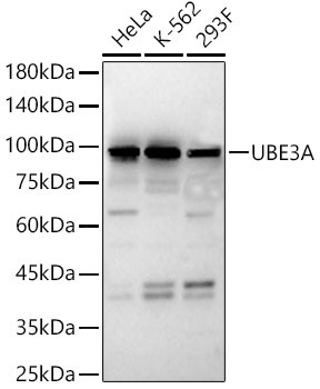 E6AP Antibody in Western Blot (WB)