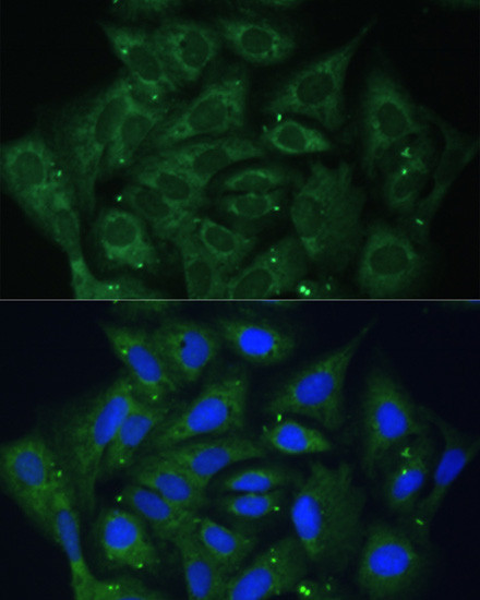 IGF2BP2 Antibody in Immunocytochemistry (ICC/IF)