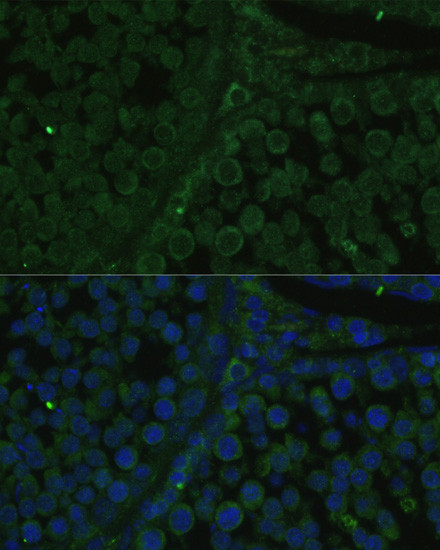 IGF2BP2 Antibody in Immunocytochemistry (ICC/IF)