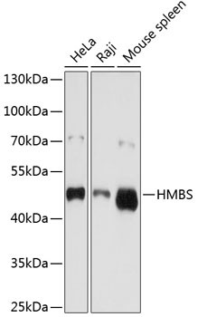 HMBS Antibody in Western Blot (WB)