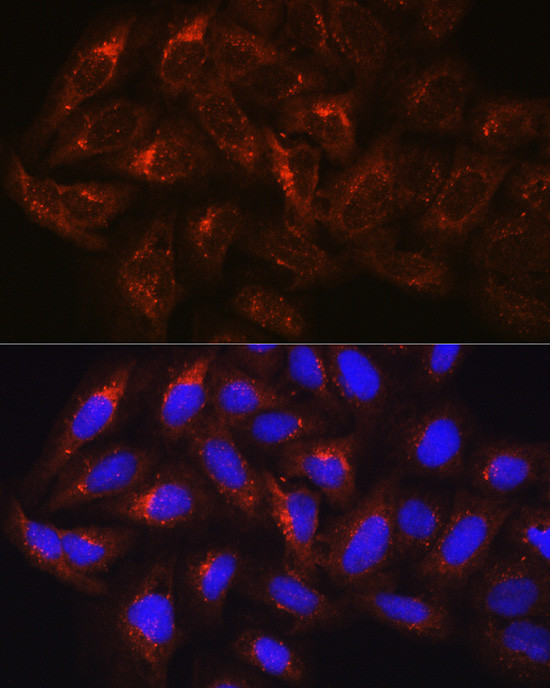 HGS Antibody in Immunocytochemistry (ICC/IF)