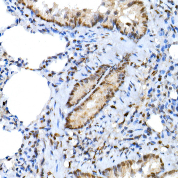 XRCC2 Antibody in Immunohistochemistry (Paraffin) (IHC (P))