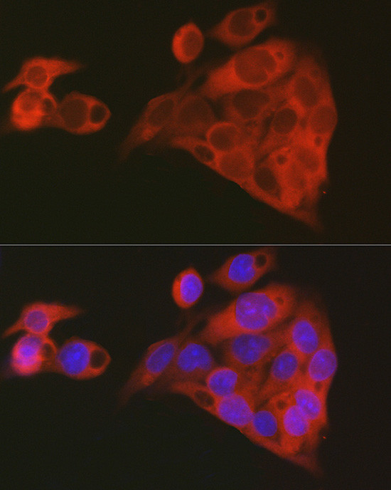 ALDH1A1 Antibody in Immunocytochemistry (ICC/IF)