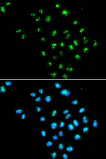 eIF6 Antibody in Immunocytochemistry (ICC/IF)