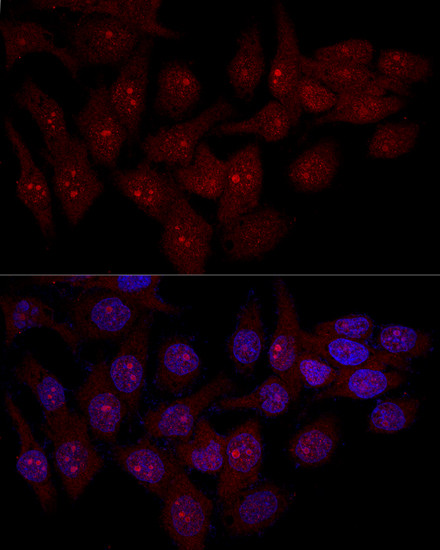 eIF6 Antibody in Immunocytochemistry (ICC/IF)