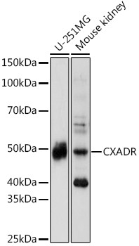 CAR Antibody in Western Blot (WB)