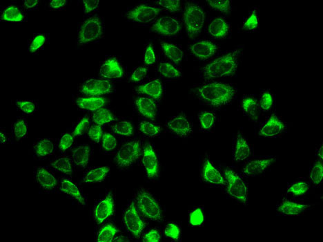 HSD3B2 Antibody in Immunocytochemistry (ICC/IF)