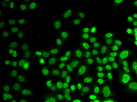 hnRNP D Antibody in Immunocytochemistry (ICC/IF)