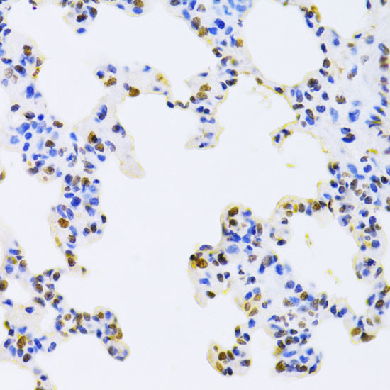 hnRNP D Antibody in Immunohistochemistry (Paraffin) (IHC (P))