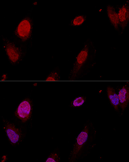 PTBP1 Antibody in Immunocytochemistry (ICC/IF)