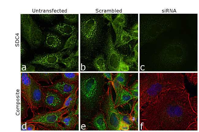 Syndecan 4 Antibody in Immunocytochemistry (ICC/IF)