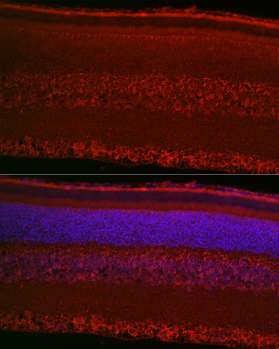 RPGR Antibody in Immunocytochemistry (ICC/IF)