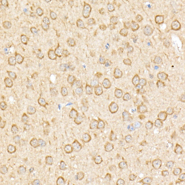 RPGR Antibody in Immunohistochemistry (Paraffin) (IHC (P))