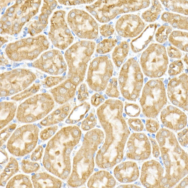 RPGR Antibody in Immunohistochemistry (Paraffin) (IHC (P))