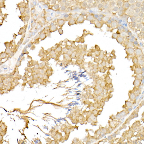 RPGR Antibody in Immunohistochemistry (Paraffin) (IHC (P))