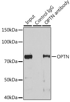 Optineurin Antibody in Immunoprecipitation (IP)