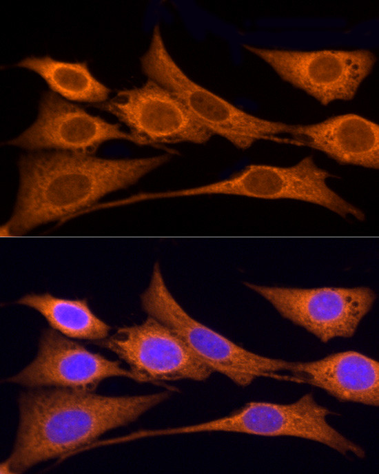 Iduronate 2 Sulfatase Antibody in Immunocytochemistry (ICC/IF)