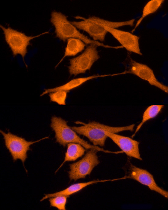 Iduronate 2 Sulfatase Antibody in Immunocytochemistry (ICC/IF)