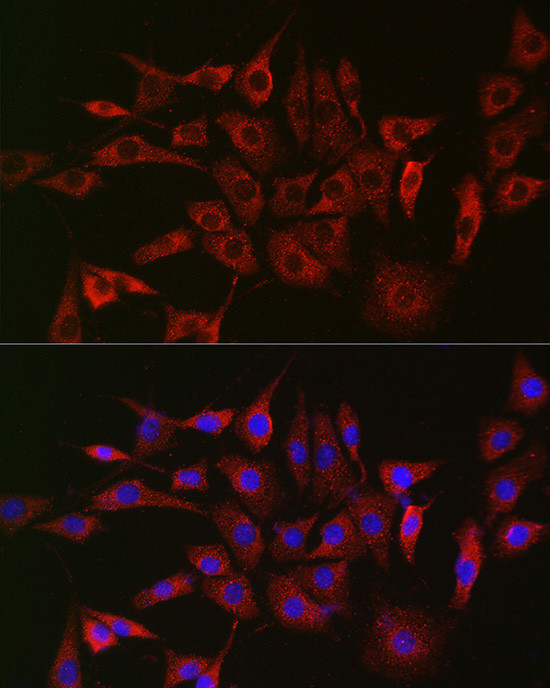 GLB1 Antibody in Immunocytochemistry (ICC/IF)