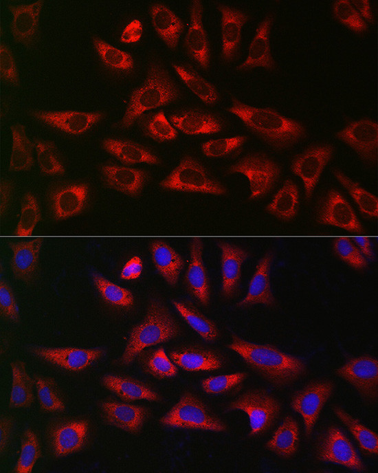 GLB1 Antibody in Immunocytochemistry (ICC/IF)