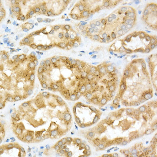 GLB1 Antibody in Immunohistochemistry (Paraffin) (IHC (P))