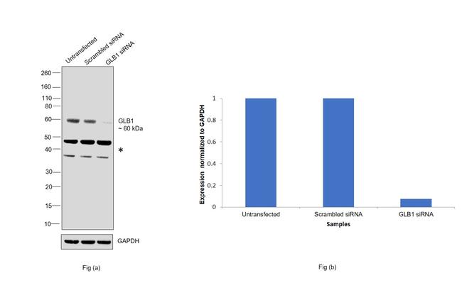 GLB1 Antibody in Western Blot (WB)