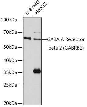 GABRB2 Antibody in Western Blot (WB)