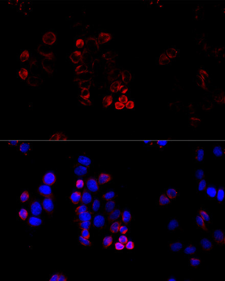 ABCG8 Antibody in Immunocytochemistry (ICC/IF)