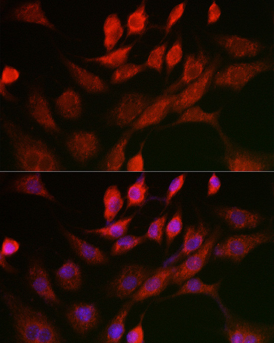 ANT Antibody in Immunocytochemistry (ICC/IF)