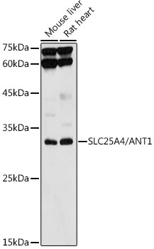 ANT Antibody in Western Blot (WB)